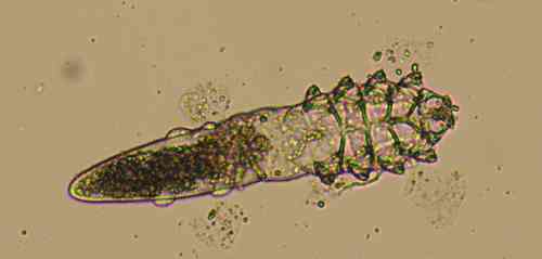 Microscopisch beeld van een Demodex canis mijt