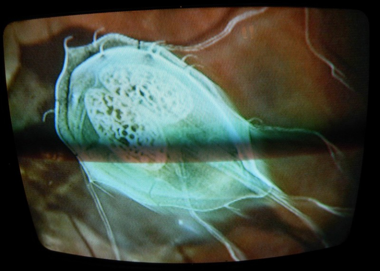 microscopisch beeld van een Giardia parasiet