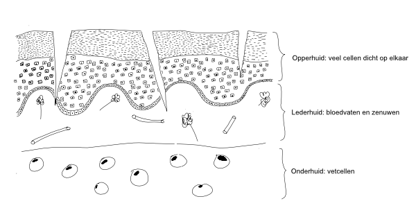 schematische doorsnede van de huid waarin scheuren en kloven ontstaan zijn.