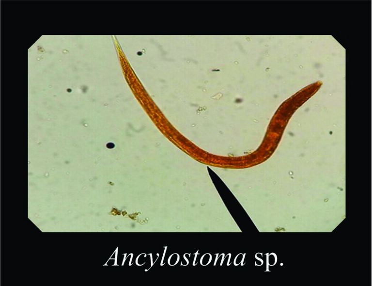 Ancylostoma worm kan de oorzaak zijn van jeuk aan de billen