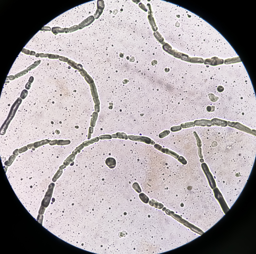 Microscopisch beeld van een huidschimmel.