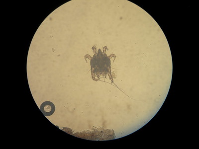 Oormijt van een kat onder een microscoop bekeken.
